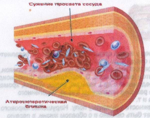 E:\Терапия\Терапия005.jpg